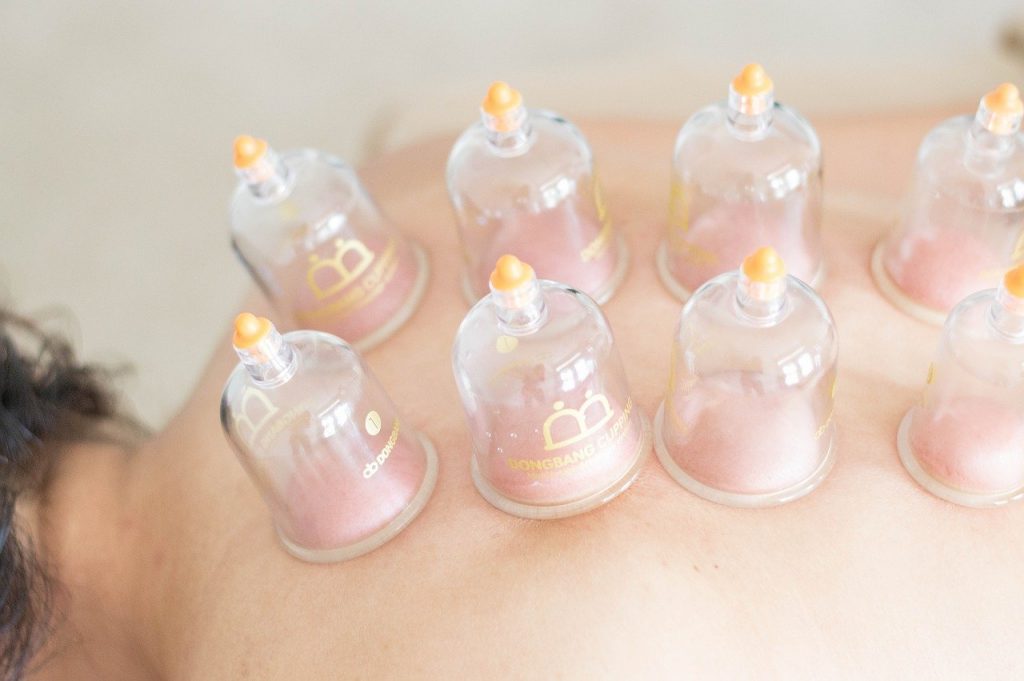 massage avec ventouses